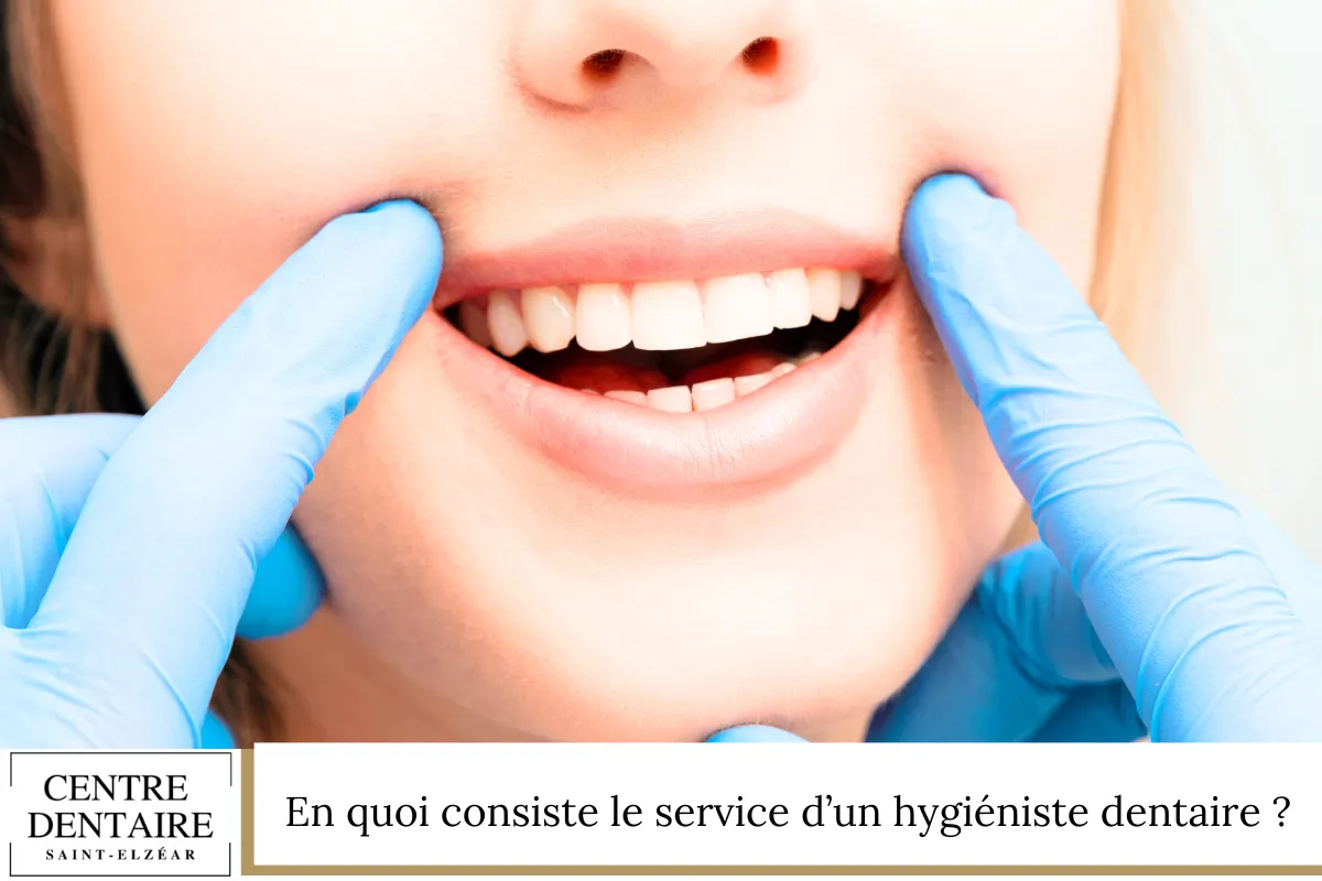 En quoi consiste le service d’un hygiéniste dentaire ?