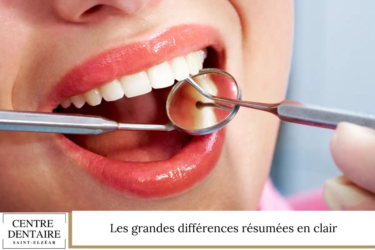 Les grandes différences résumées en clair