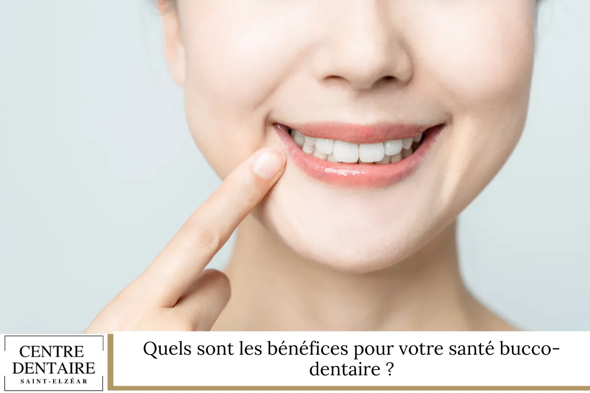 Quels sont les bénéfices pour votre santé bucco-dentaire ?