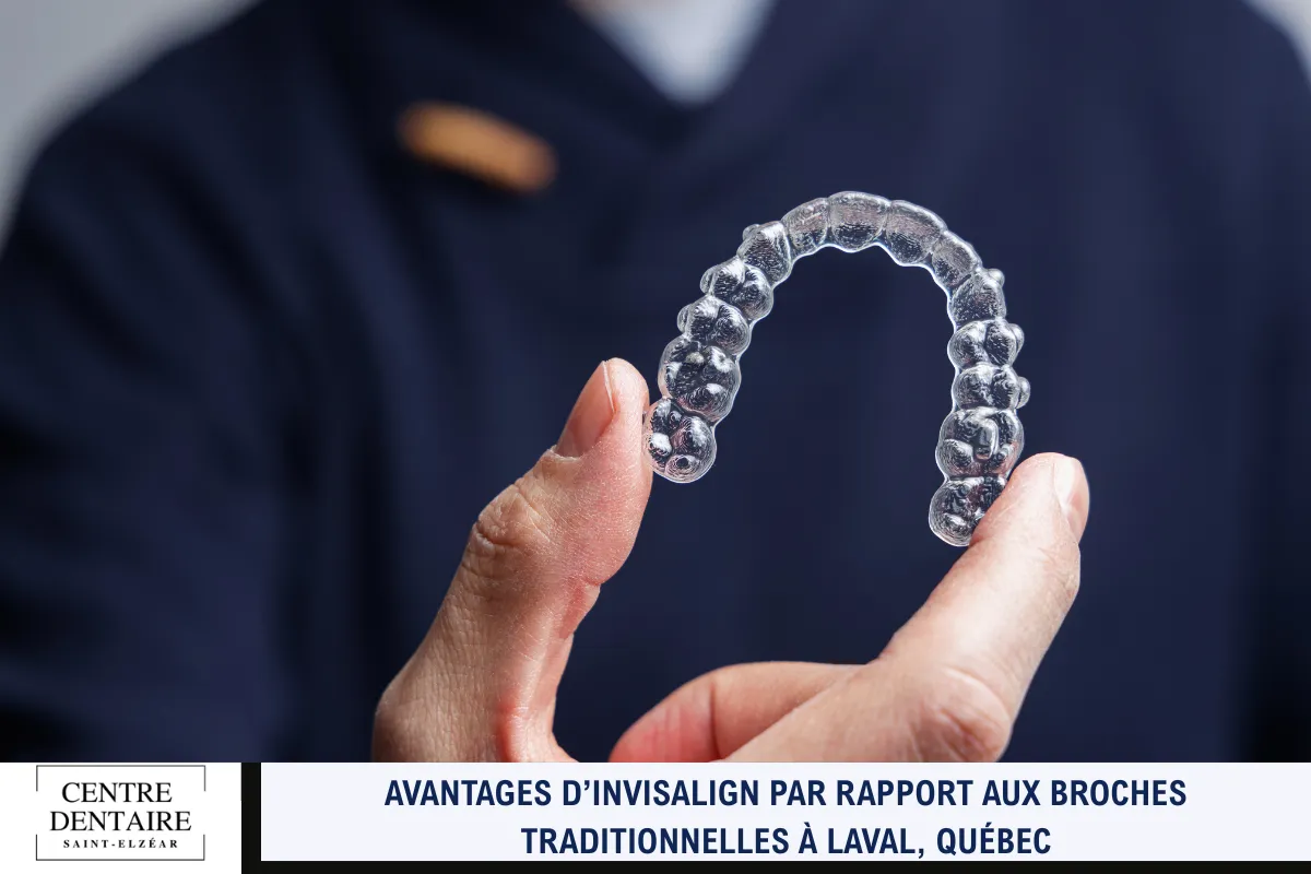 Avantages d’Invisalign par rapport aux broches traditionnelles à Laval, Québec
