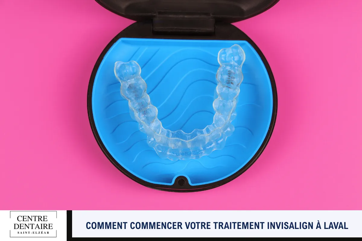 Comment commencer votre traitement Invisalign à Laval