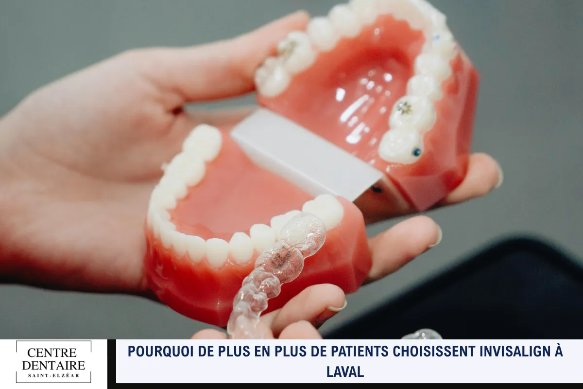 Pourquoi de plus en plus de patients choisissent Invisalign à Laval