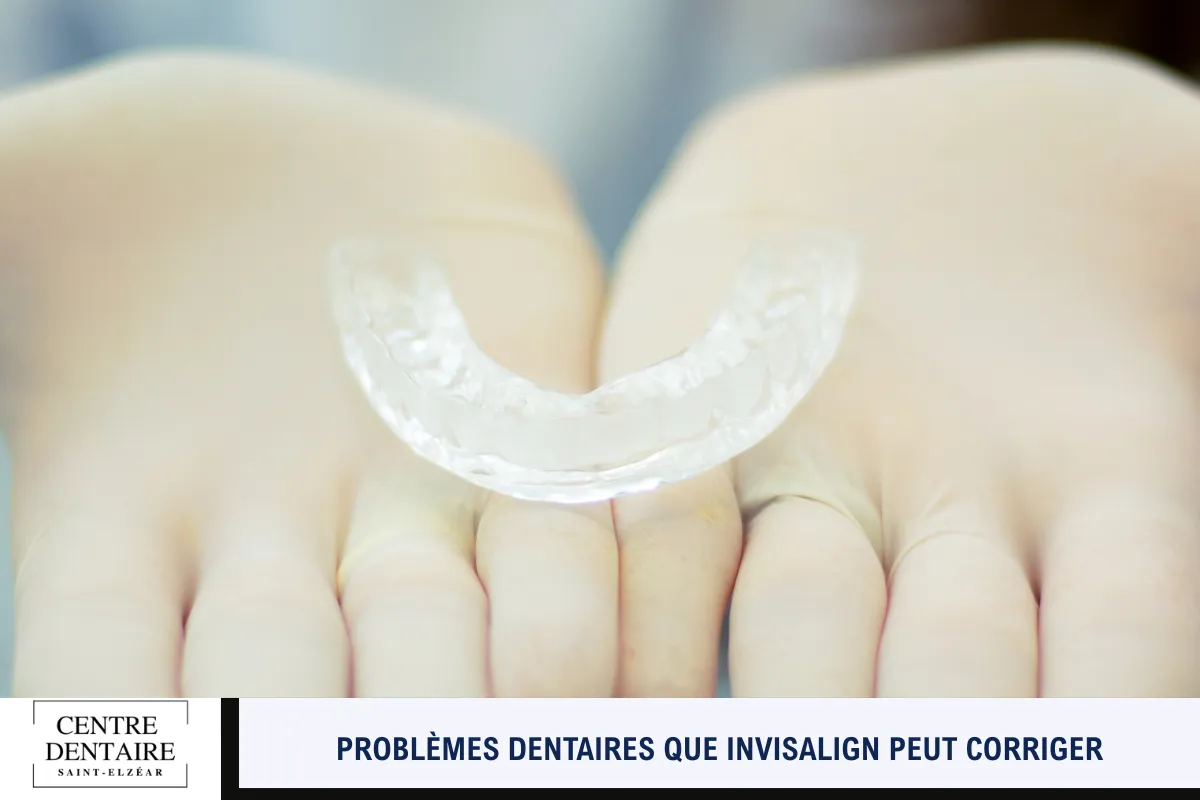 Problèmes dentaires que Invisalign peut corriger