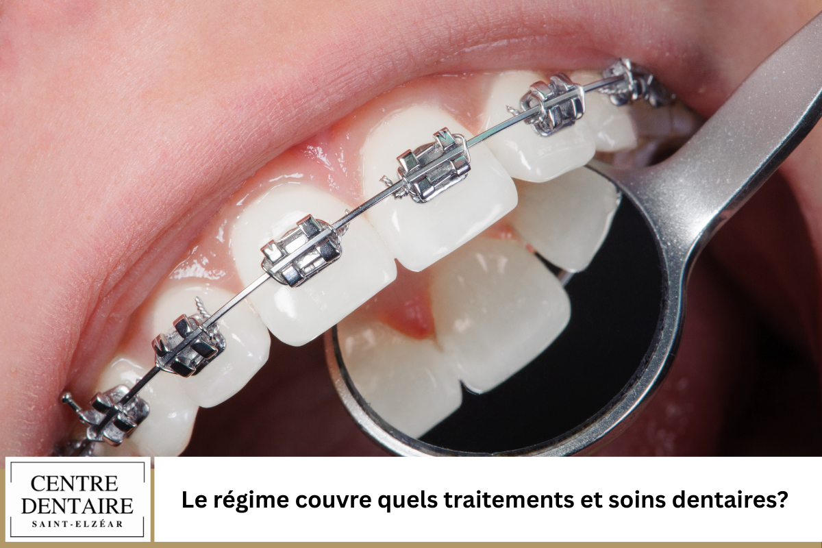 Le régime couvre quels traitements et soins dentaires
