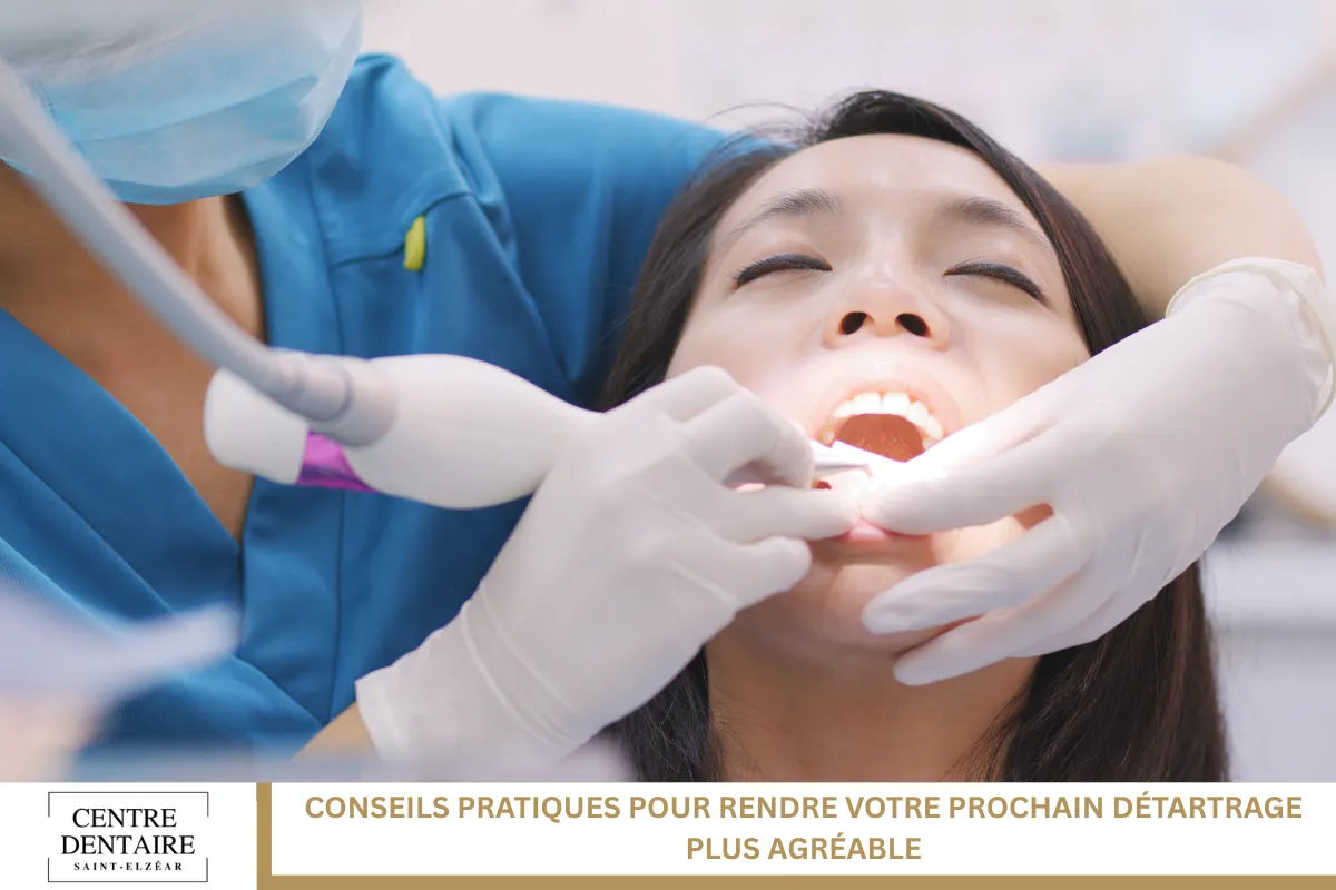 Conseils pratiques pour rendre votre prochain détartrage plus agréable