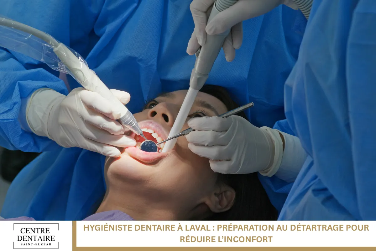 Hygiéniste dentaire à Laval : Préparation au détartrage pour réduire l’inconfort