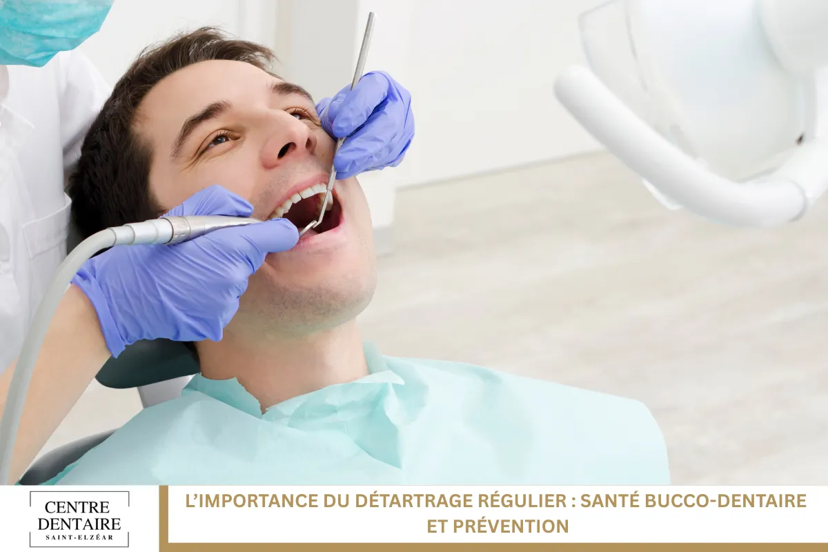 L’importance du détartrage régulier : santé bucco-dentaire et prévention