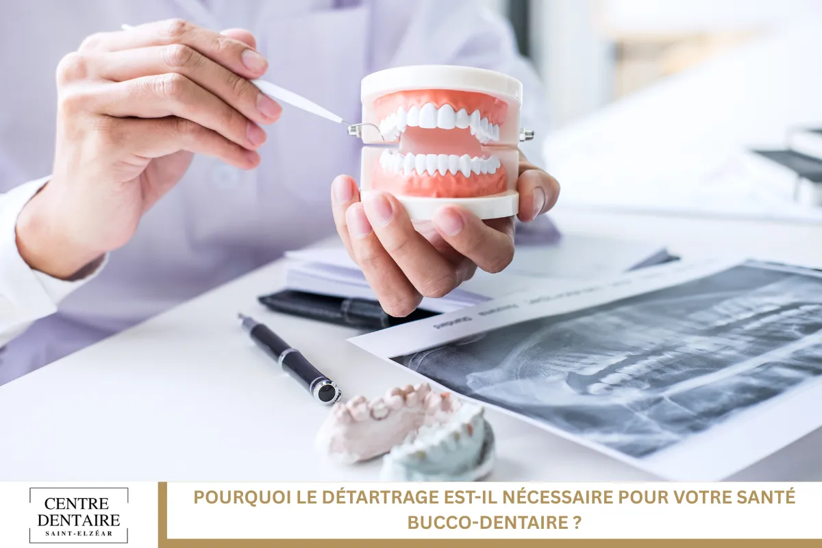 Pourquoi le détartrage est-il nécessaire pour votre santé bucco-dentaire ?