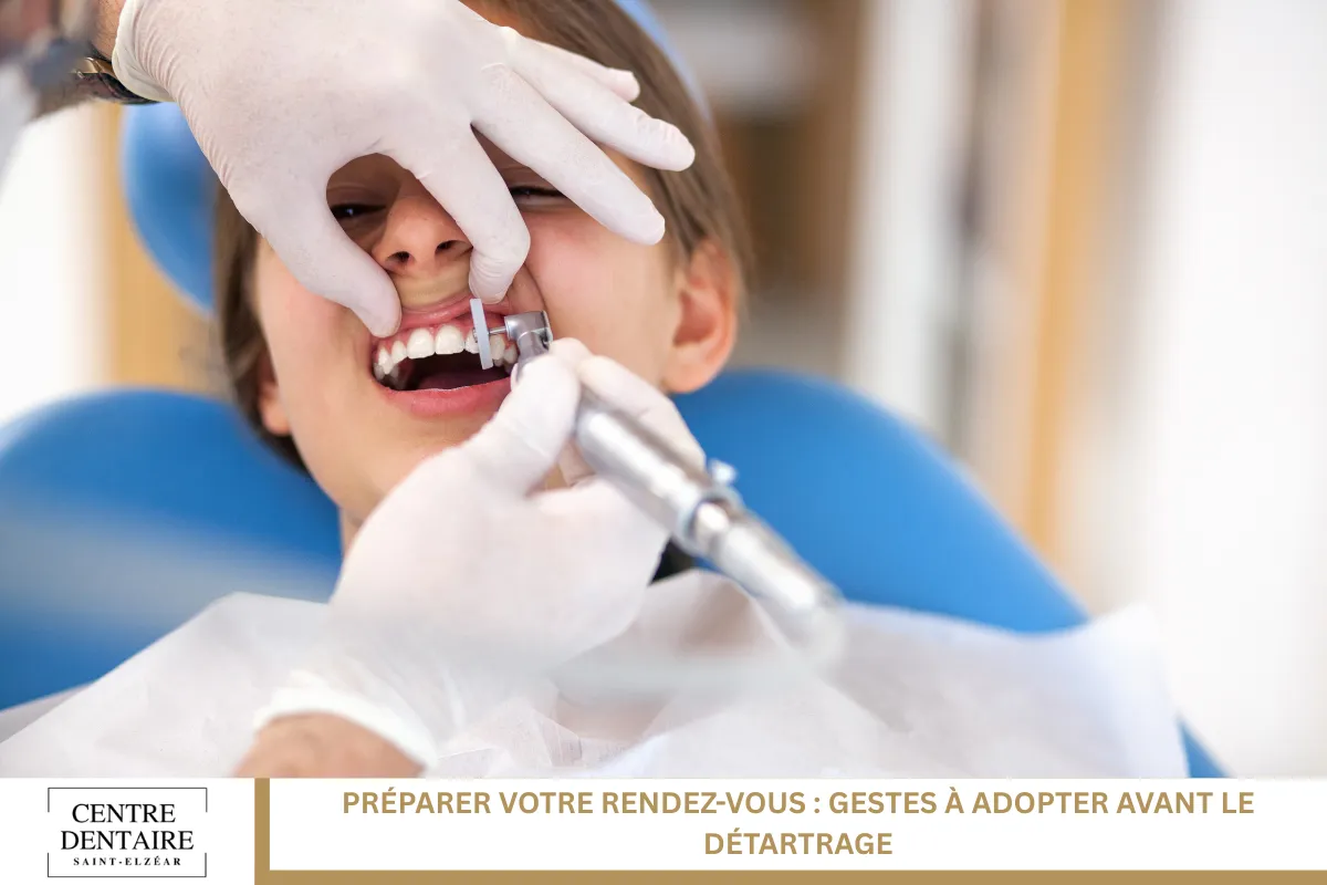 Préparer votre rendez-vous : gestes à adopter avant le détartrage