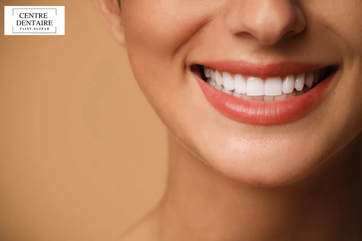 Un suivi régulier : la clé d’une bouche saine sans douleur